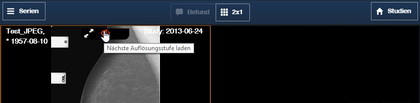 Auflösungsstufe nachladen Auflösungsstufe nachladen